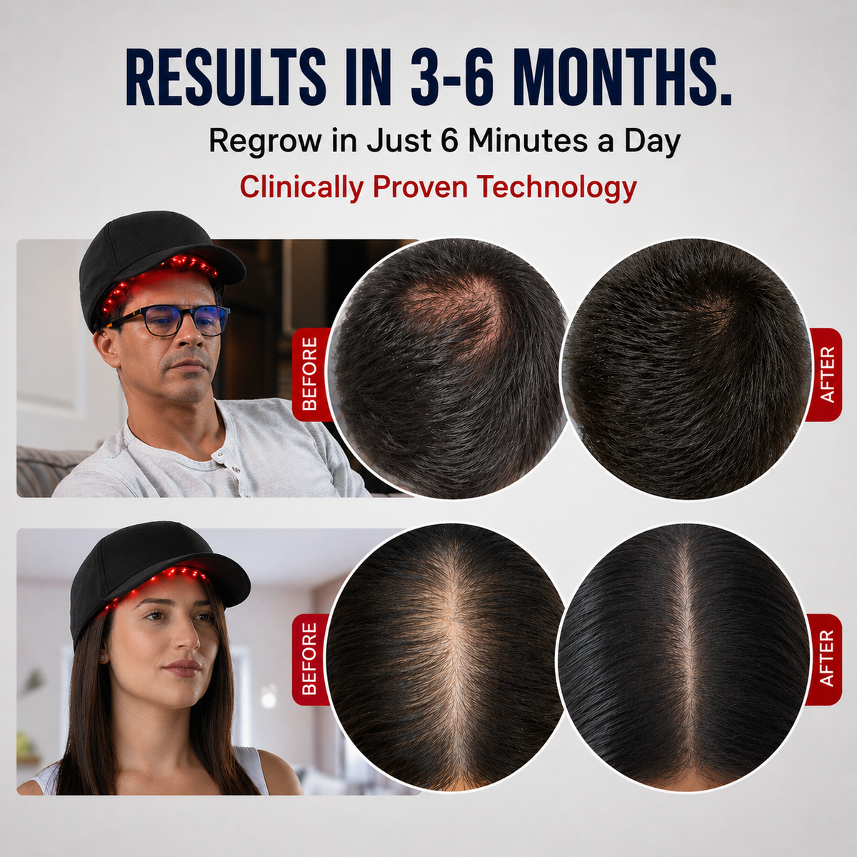 HairRevive™ Therapy Cap
