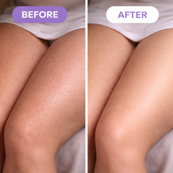 Crystal Smooth Hair Eraser Tool