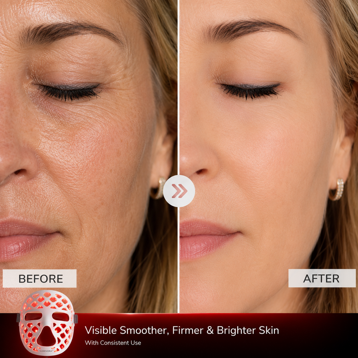 Lumivora™ Red Light Therapy Mask