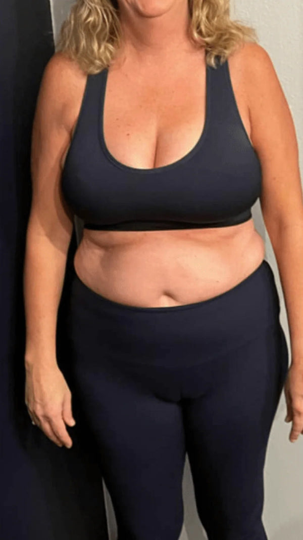 Before - Lauren G.