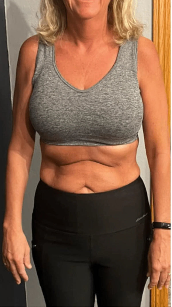 After - Lauren G.